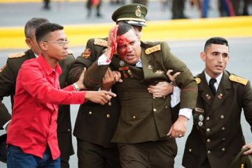 militar-venezolano-herido