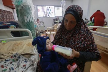 Niño que sufre de malnutrición en un centro de salud en Rafah